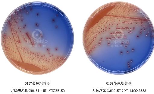 O157显色培养基