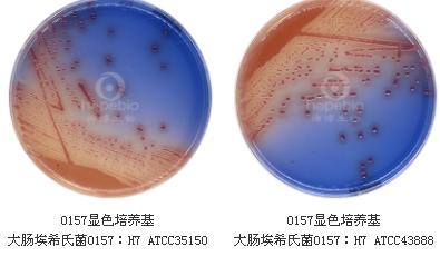 O157显色平板9cm（2-8℃）
